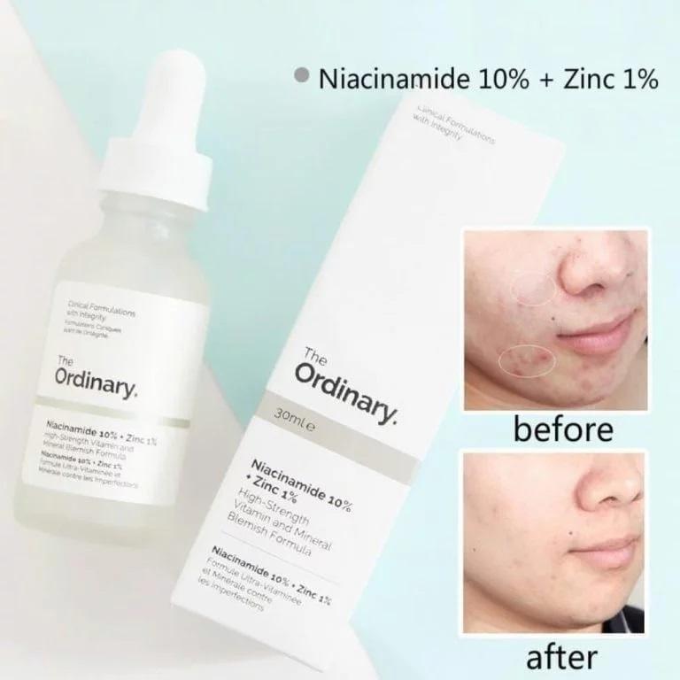 Material: Liquid
Volume: 30ml
Functions: Skin Brightening, Evens Tone, Hydration Boost
Texture: Lightweight & Fast-Absorbing
Skin Feel: Plump, Smooth, Refreshed
Package Includes: 1 x Serum